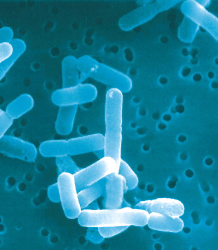 Mundflora im Gleichgewicht: Lactobacillus reuteri Prodentis – klinisch getestet – ZWP online ...